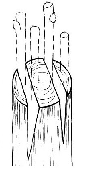 Guide complet de la greffe de pommier fendu pour débutants