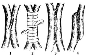 Méthodes de greffage des arbres fruitiers au printemps : choisir la méthode optimale